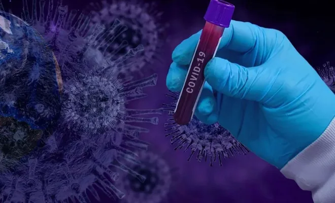 Türkiye'de son 24 saatte 77 can kaybı, 2305 yeni tanı kondu