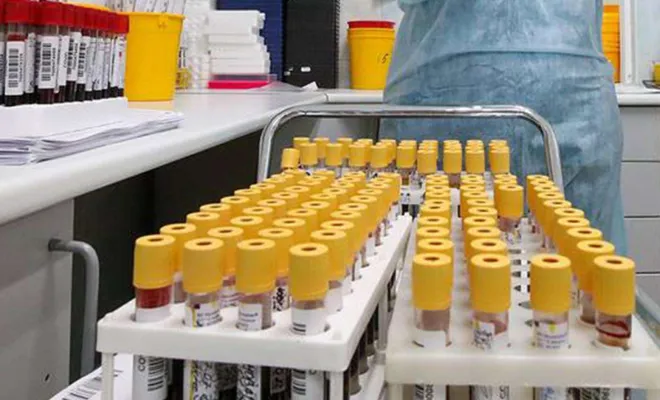 Türkiye'de son 24 saatte 77 kişi Covid-19'dan hayatını kaybetti 