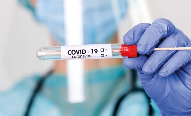 Türkiye'de son 24 saatte 103 kişi hayatını kaybetti 3819 yeni Covid-19 tanısı kondu 