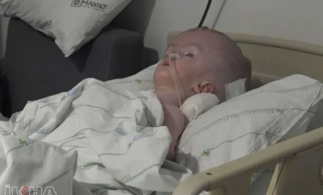 Umut Kervanı'nın aracı olduğu Hidrosefali hastası minik Yakup Elazığ`da ameliyat oldu