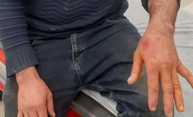 Kovancılar`da tavuk kümesine giren sokak köpekleri kümes sahibini yaraladı 